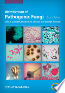 Identification of pathogenic fungi /