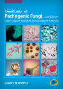 Identification of pathogenic fungi /