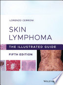 Skin lymphoma : the illustrated guide /