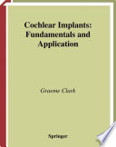 Cochlear implants : fundamentals and applications /