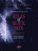 Dermatological atlas of black skin /