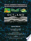 Optical coherence tomography in age-related macular degeneration : OCT in AMD /