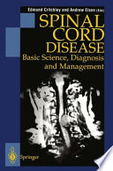 Spinal Cord Disease : Basic Science, Diagnosis and Management /
