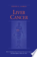 Liver Cancer /