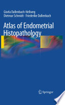 Atlas of endometrial histopathology /