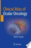 Clinical Atlas of Ocular Oncology /