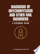 Diagnosis of onychomycosis and other nail disorders : a pictorial atlas /