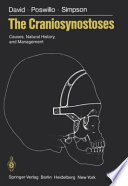 The Craniosynostoses : Causes, Natural History, and Management /