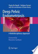 Deep pelvic endometriosis : a multidisciplinary approach /