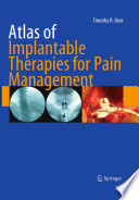 Atlas of implantable therapies for pain management /