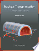 Tracheal Transplantation Current Possibilities /
