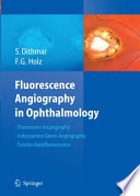 Fluorescence angiography in ophthalmology /