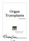 Organ transplants /