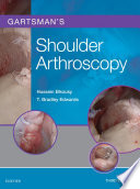 Gartsman's shoulder arthroscopy /