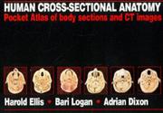 Human cross-sectional anatomy : pocket atlas of body sections and CT images /