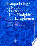 Histopathology of nodal and extranodal non-Hodgkin's lymphomas : based on the WHO classification /