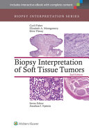 Biopsy interpretation of soft tissue tumors /