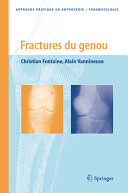 Fractures du genou /