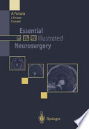 Essential illustrated neurosurgery /