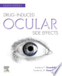Drug-induced ocular side effects /
