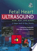 Fetal heart ultrasound : how, why, and when--3 steps and 10 key points /