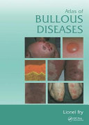 Atlas of bullous diseases /