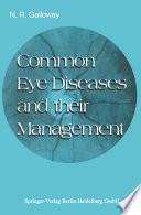 Common eye diseases and their management /