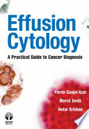 Effusion cytology : a practical guide to cancer diagnosis /