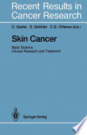Skin Cancer: Basic Science, Clinical Research and Treatment /