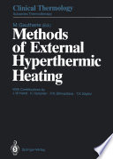 Methods of External Hyperthermic Heating /