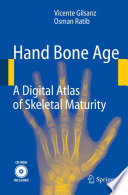 Hand bone age : a digital atlas of skeletal maturity /