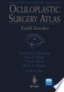 Oculoplastic surgery atlas : eyelid disorders /