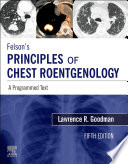 Felson's principles of chest roentgenology : a programmed text /