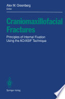 Craniomaxillofacial Fractures : Principles of Internal Fixation Using the AO/ASIF Technique /