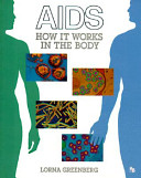 AIDS : how it works in the body /