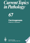 Carcinogenesis /