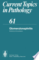 Glomerulonephritis /