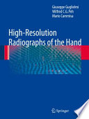 High-resolution radiographs of the hand /