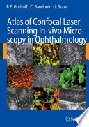 Atlas of confocal laser scanning in-vivo microscopy in opthalmology [as printed] : principles and applications in diagnostic and therapeutic ophtalmology [as printed] /