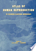 Atlas of Human Reproduction : By Scanning Electron Microscopy /