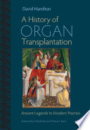 A history of organ transplantation /
