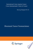 Illustrated Tumor Nomenclature = Nomenclature illustrée des Tumeurs = Illustrierte Tumor-Nomenklatur = Nomenclatura ilustrada de los Tumores /