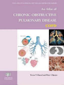 An atlas of chronic obstructive pulmonary disease, COPD /