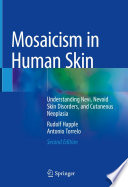 Mosaicism in Human Skin : Understanding Nevi, Nevoid Skin Disorders, and Cutaneous Neoplasia /