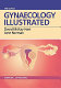 Gynaecology illustrated /