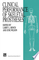 Clinical Performance of Skeletal Prostheses /