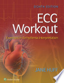 ECG workout : exercises in arrhythmia interpretation /