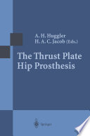 The Thrust Plate Hip Prosthesis /