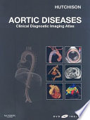 Aortic diseases : clinical diagnostic imaging atlas /