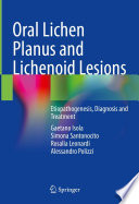 Oral Lichen Planus and Lichenoid Lesions : Etiopathogenesis, Diagnosis and Treatment /